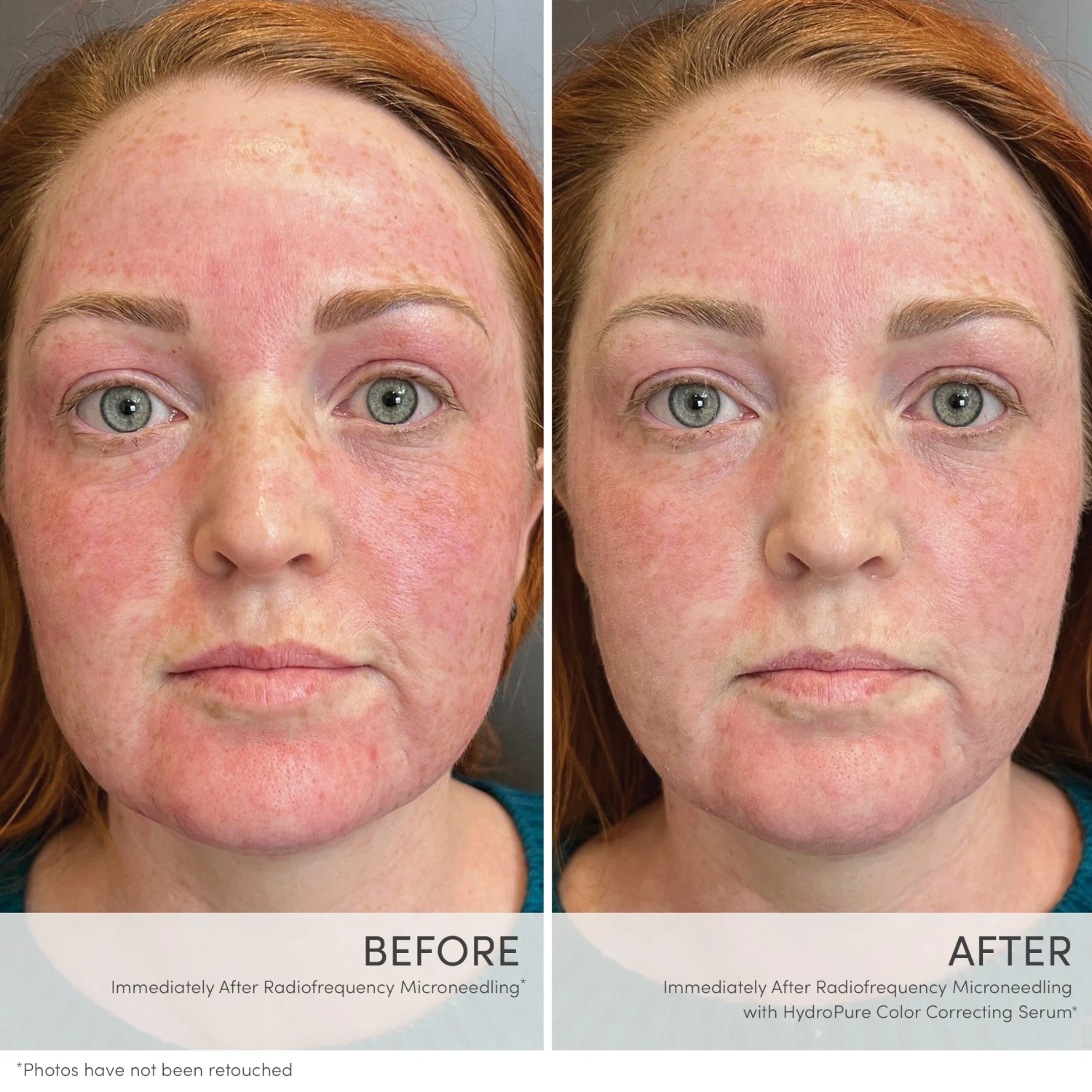 Jane Iredale HydroPure™ Color Correcting Serum With Hyaluronic Acid & CoQ10 - Imagen 7